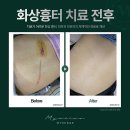 어바인피부과의원 | 국회의사당역 피부과 전문 병원 추천 TOP 6곳