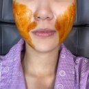 신논현피부과에서 민트실리프팅으로 팔자주름 관리하려다가 얼굴라인까지 정리된 후기