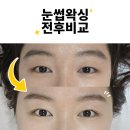 서울대입구역 눈썹 컨설팅, 비대칭 교정 하나로 인상 변화! <블랙여우 왁싱&amp;속눈썹> 인생 후기 (주차/과정)