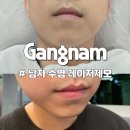 차가꾸는남자 | 강남 수염제모 후기! 짝꿍의 인생 첫 남자 레이저제모 수염들아 이제 안녕!