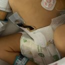 씨유 강릉아산드림점 | 강릉 세가온산부인과 제왕절개 4일차 | 강릉 아산병원 신생아집중치료실 첫 면회 | 그리고.. 잊은 그의...