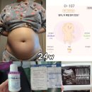 이마트24 임당코아루점 | 24주 배크기 태동 배뭉침 증상 임산부 식단 임당검사 정밀초음파