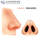 강남-032 | 강남코필러가격 후기보다 중요한 단1가지