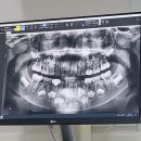 치카푸카소아치과의원 이미지