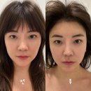 실용지구 | 의정부피부관리 민락2지구 스파연 2번째 방문, 실용관리 + 등관리 후기