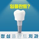[진주치과추천] 임플란트잘하는진주치과 청심플란트 추천