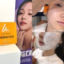 멍묭실 | 강남피부과 올리톡(올리지오300샷+스킨보톡스) 7일차 경과 통증 효과