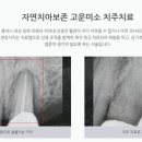 누가치과의원 이미지