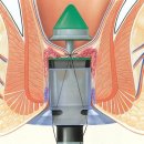 상쾌한 항구병원 이미지