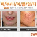 백설공주의원 네이버블로그
