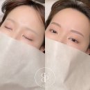 비프리티 이미지