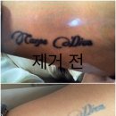 끌리어의원 네이버블로그