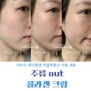 (주)아이알엔디벨로퍼 | 아누아 [SET] PDRN 팔자 주름 관리 콜라겐 크림 세트 후기 (내돈내산)