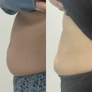 텐미라클 | 일산 헬스장 알아보다 쥬비스 일산점 시작했는데, 2주 만에 앞자리가 바뀌고 눈바디도 달라졌어요