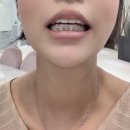 [큐원치과]강남 역삼동큐원치과/정기검진/교정/부분교정/부분교정잘하는곳/강남치과/믿을 수 있는 치과