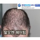 헤어(hair)39