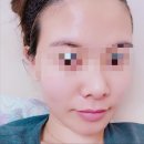 비알바이오