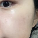 (주)메디스타 | [피부과 화장품] 화사한 얼굴 갖고싶어? @ㅏ 드루와 드루와 <아임서울 퓨어 비타씨 앰플>