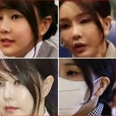 계엄날 김건희 다녀간 의혹 강남 성형외과 대통령 자문 의사 병원 별점 테러 (ft.안면거상 수술 리프팅...