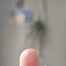 봉수로 | [부산]연산동 장호선피부과 손가락사마귀 냉동치료 2차후기