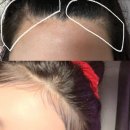 바로라인 | 청주 용암동 자연스러운 잔머리펌후기 이마라인 커버 완성