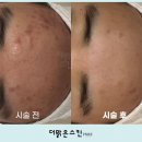 오룡1호 이미지