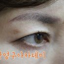 정희헤어라인 이미지