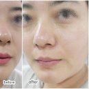 브라운랩(BROWNLAB) 네이버블로그