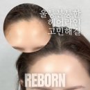 이미지헤어라인 이미지