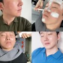코디의원 | 벨뷰의원 포텐자 레이저 2번째 후기 (효과, 통증, 부작용, 주기는?)