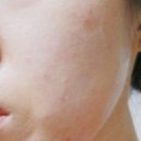 피부 고민 해결을 위한 수니43 피부장벽 개선 크림 후기