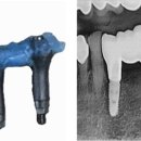 장치과기공소 이미지