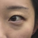 인계365힐링의원 | ✨ 올라래쉬 수원인계본점 무쌍 속눈썹펌 후기(feat. 겹주름 눈매교정) ✨