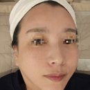 센텀6로 | 부산 센텀 색소침착치료 피부과 추천, 얼굴피부 잡티제거 시술 컨택터 6회차 후기