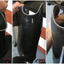 중앙의지보조기 이미지