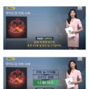 귓밥을 파면 안되는 이유 이미지