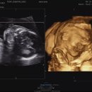 맘존 여성병원 이미지