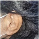 포낙보청기 강동센터 이미지