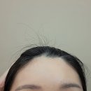 이마 | [웨딩관리] 뷰티프렌즈왁싱 강남점-헤어라인+이마 왁싱 후기 ❤️