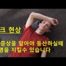 봉크현상이란? 이미지