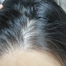 지성메디텍 | 헤어토닉 추천, 몬퓨리엘 헤어로스케어 기능성 토닉