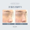 글로우의원 이미지