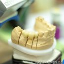 이라인미소치과교정과치과의원 네이버블로그