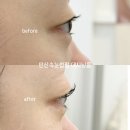 광덕4로5 | 안산 속눈썹펌 데시닝룸 방문후기 무쌍 속눈썹도 살아난 컬링