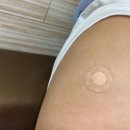 지동하이비인후과의원 네이버블로그