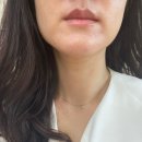 안녕네모 | 울쎄라 300샷 + 써마지 600샷 내돈내산 (네모가 된 후기)