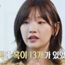 국내 발생 1위 암인데, 증상 뚜렷하지 않아… "박소담도 번아웃인 줄만 알았다" 이미지