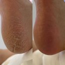 미용실리인 | 아산 발각질 건조하고 두꺼운 각질 고민이라면, 레푸스 아산탕정점 관리 후기