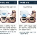 코스트코안경 이미지