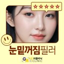 필러시술후 눈밑꺼짐필러 효과 가격 잘하는곳 주기